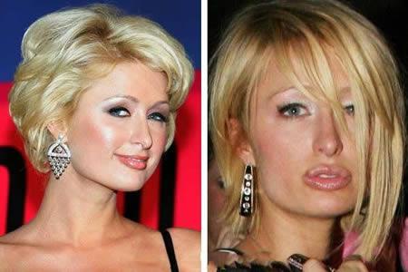 Paris Hilton Autors: Khalifa 12 Sliktākās plastiskās operācijas