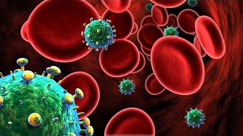 HIV AIDSVēl viena slimība... Autors: Lestets Nāvējošākie vīrusi vēsturē
