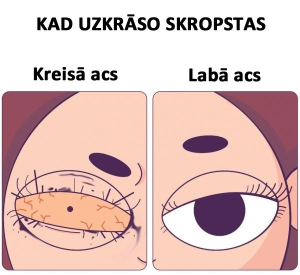 Autors: matilde Patiesi komiksi, kuros atspoguļota «sāpīgā» meiteņu dzīve. Nabadzītes!