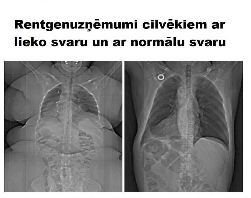 Autors: The Diāna 15 izglītojoši attēli par cilvēka ķermeni