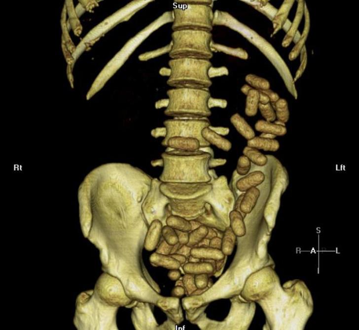 Tā izskatās... Autors: Lestets 15 rentgenuzņēmumi, kas atklās par ķermeni vairāk nekā anatomijas grāmatas